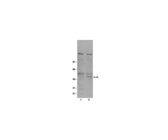 62-8372-18 Anti-phospho-GSK3β (Ser9), clone 2D3; 100 μg 05-643