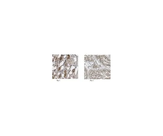 62-8444-21 Anti-PNMT Antibody AB110-I