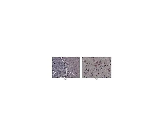 62-8466-15 Anti-DBN1 Antibody Cat. No. ABN207 ABN207