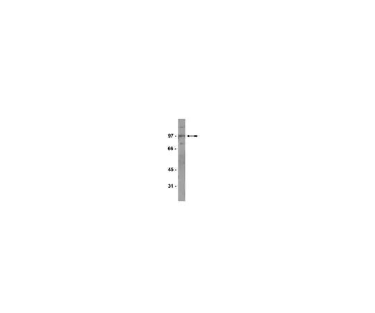 62-8372-28 Anti-Kaiso, clone 6F; 200 μg 05-659