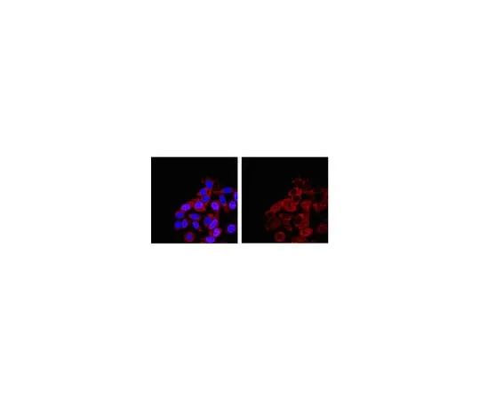 62-8367-59 RIPAb+(TM) SMN; 10 assays 03-200