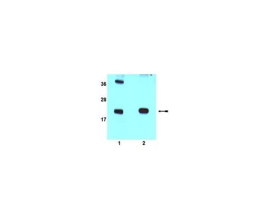 62-8389-56 Anti-Rac1b; 100μL 09-271