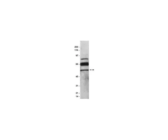 62-8384-32 Anti-PEDF; 200 μg 07-280