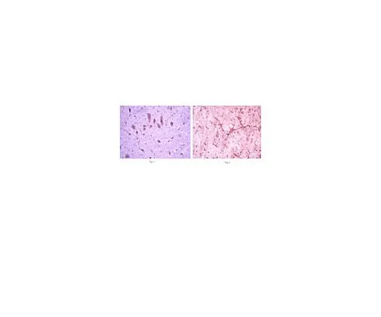 62-8454-67 Anti-mGluR8; 100 μL AB10556