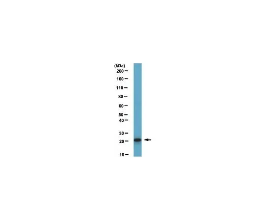62-8460-44 Anti-ASF1a; 100 μL ABE149