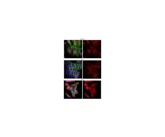 62-8452-30 Anti-Thymosin beta-4; 100 μg AB6019