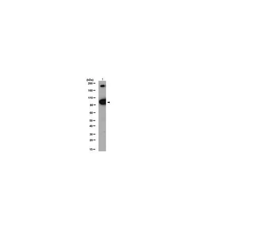 62-8386-44 Anti-a-Insulin Receptor, β subunit; 100 μL 07-724