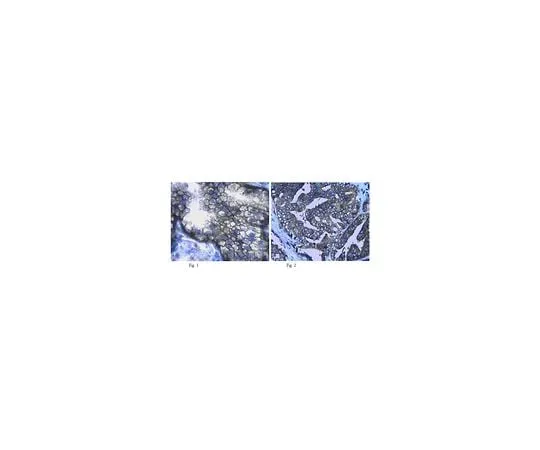 62-8465-59 Anti-Neutral amino acid transporter (ASCT2); 100 μg ABN73