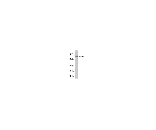 62-8386-49 Anti-CENP-B; 100 μg 07-735