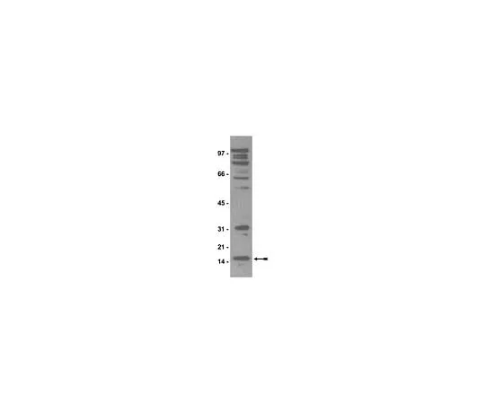62-8384-90 Anti-dimethyl-Arginine, symmetric (SYM11); 200 μg 07-413