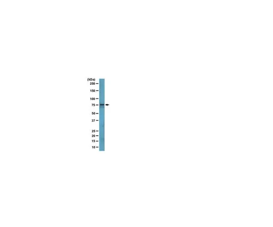 62-8369-53 Anti-Bruton's tyrosine kinase (Btk), clone 10D11; 100 μg 04-1578