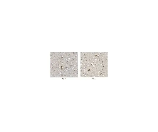 62-8467-29 Anti-Choline Transporter ABN458