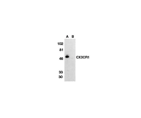 62-8445-95 Anti-C-X-X-X-C Chemokine Receptor 1, extracellular loop; 100 μg AB1891