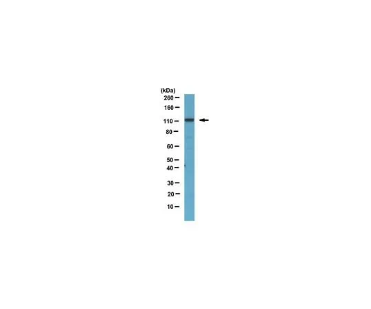 62-8458-46 Anti-phospho-CYLD (Ser418) ABC478