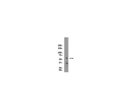 62-8389-75 Anti-AIRE; 100 μg 09-456