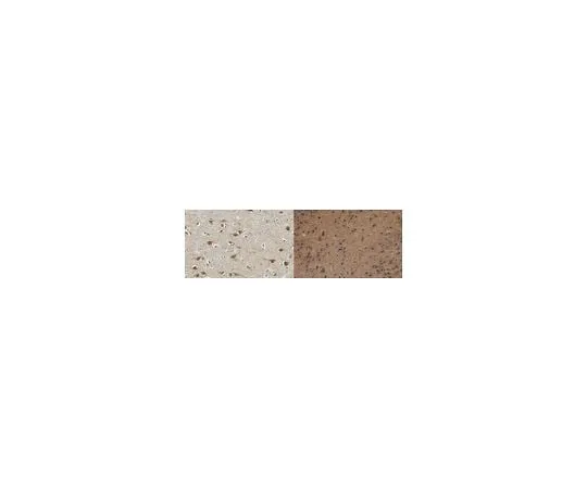 62-8465-37 Anti-Homer1; 100 μg ABN37