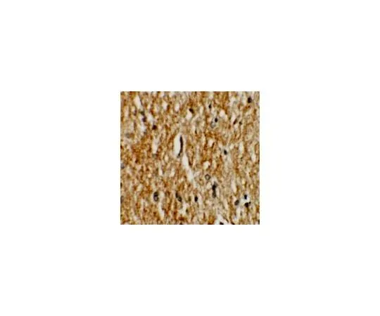 62-8467-62 Anti-PHOX2A ABN494