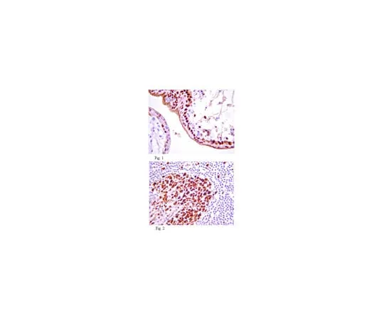 62-8375-37 Anti-IGF-1R, clone 24-57; 100 μg 05-1571