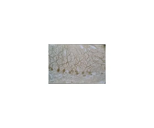 62-8445-30 Anti-NMDAR2B; 10 μg AB1557P
