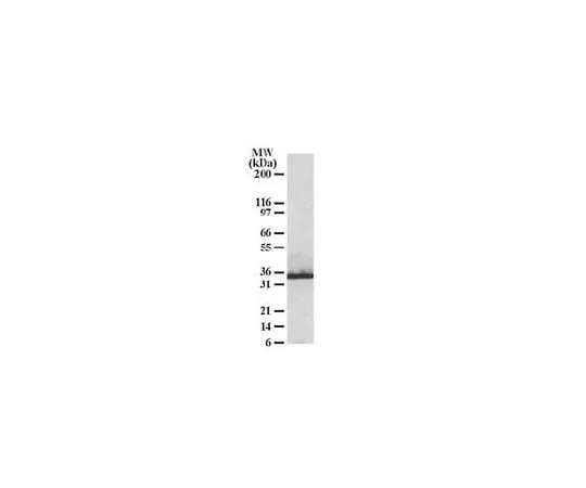 62-8453-96 anti-CHIP/STUB1; 100 μg AB10000