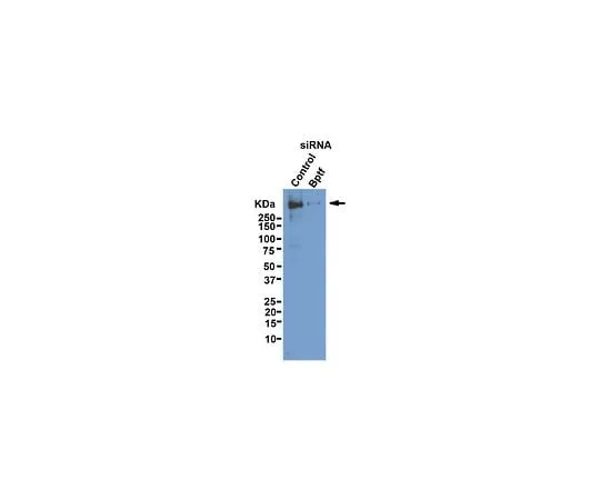 62-8459-99 Anti-BPTF; 100 μg ABE24