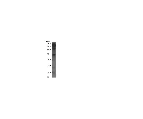 62-8392-88 4G10R Platinum, Anti-Phosphotyrosine, Agarose Conjugate; 200 μL 16-638