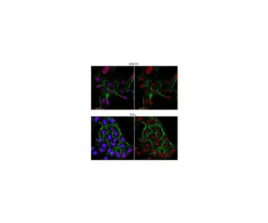 62-8390-11 Anti-JHDM1B; 100 μg 09-864
