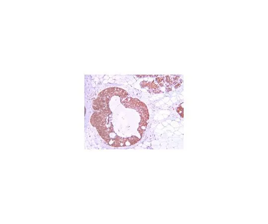 62-8387-54 Anti-phospho-Akt (Thr308); 100 μL 07-1398