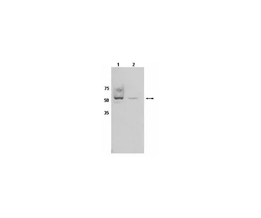 62-8454-07 Anti-CYP450, clone 2E1; 100 μg AB10080