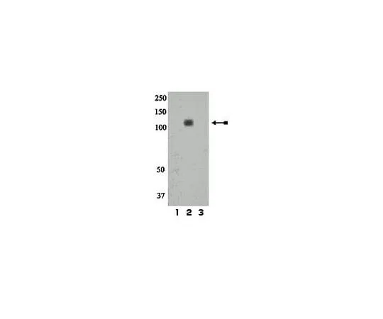 62-8386-78 anti-phospho-IR/IGF1R (Tyr1158); 100 μL 07-839