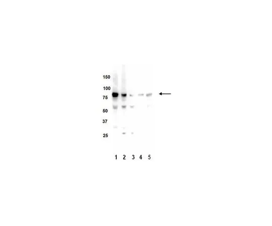 62-8373-91 Anti-PKC (α, β, γ), Clone M110; 100 μL 05-983