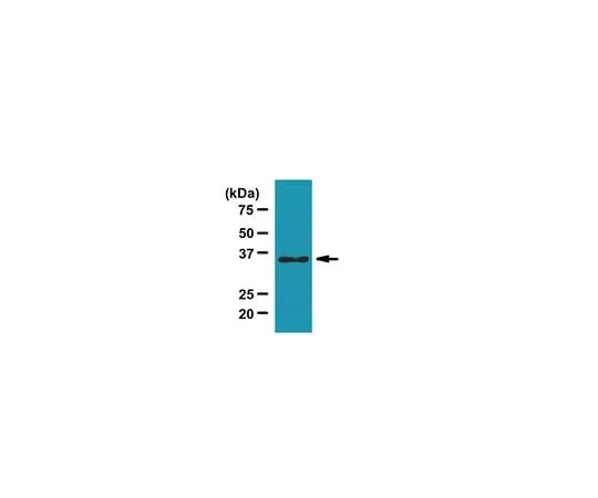 62-8459-28 Anti-Sorting Nexin-11 Antibody ABC1444