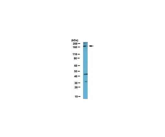 62-8460-67 Anti-Set1A; 100 μL ABE212