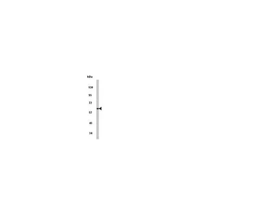 62-8454-40 Anti-PACSIN1, N-terminus; 100 μg AB10439