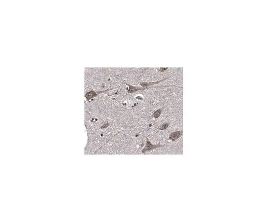 62-8466-59 Anti-SCRAPPER ABN327
