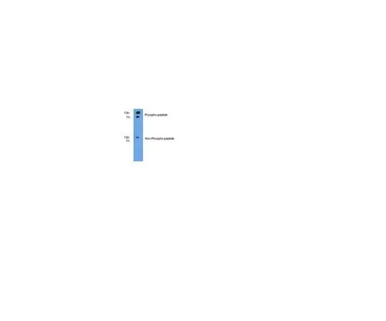 62-8454-05 anti-phospho-ITCH (pT222); 100 μg AB10050