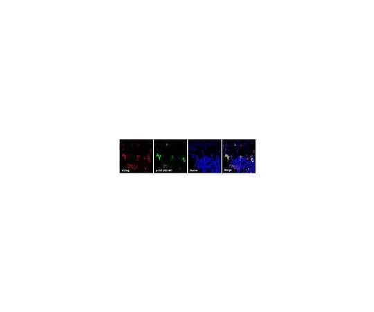 62-8468-19 Anti-C9ORF72/C9RANT (Poly-GR) ABN1361