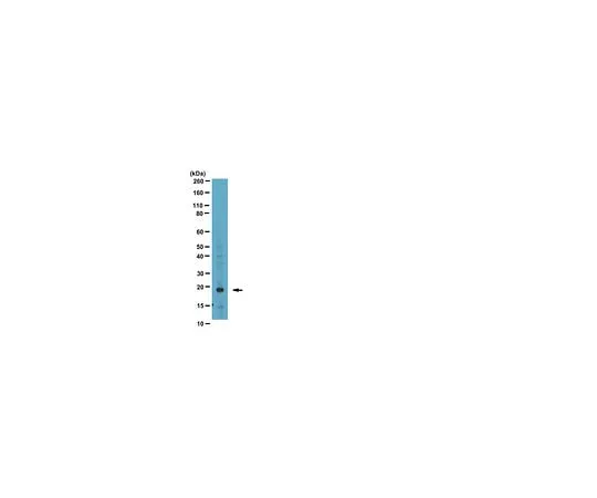 62-8454-38 Anti-Phospho-Bad (Ser99); 100 μg AB10424