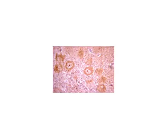 62-8374-33 Anti-PDGFR-ß, clone CH-3 (mo*** monoclonal) 05-1135