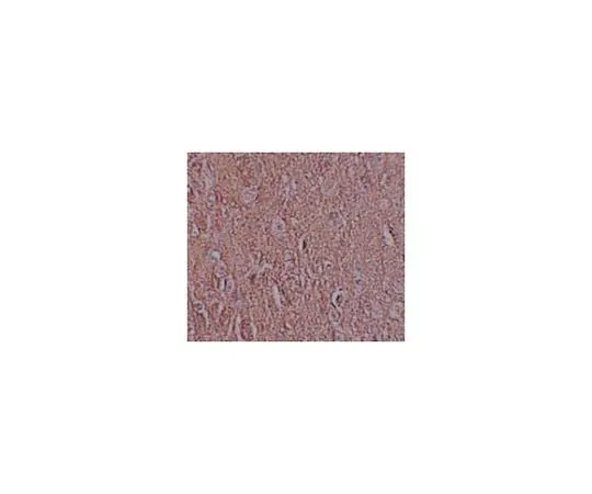 62-8467-76 Anti-LRRTM2 ABN643