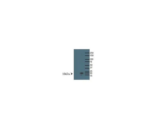 62-8455-69 Anti-LMO4; 100 μg AB15640