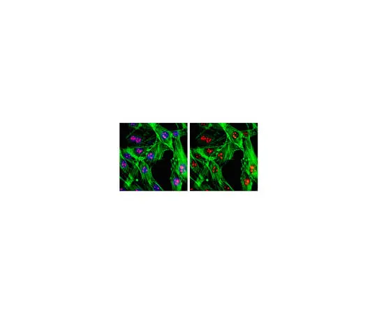 62-8369-38 Anti-SC-35, clone 1SC-4F11; 100 μL 04-1550