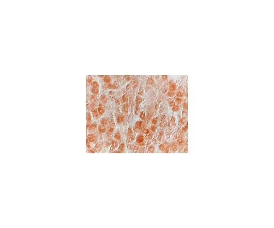 62-8445-08 Anti-Nerve Growth Factor-beta, pain; 20 μg AB1526P