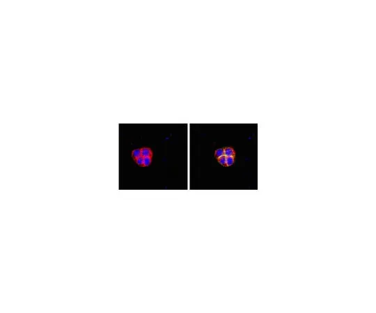 62-8367-42 RIPAb+(TM) Fragile X Mental Retardation Protein; 10 assays 03-108