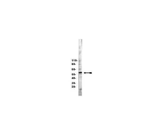 62-8386-02 Anti-HNF3β/FOXA2; 200 μg 07-633