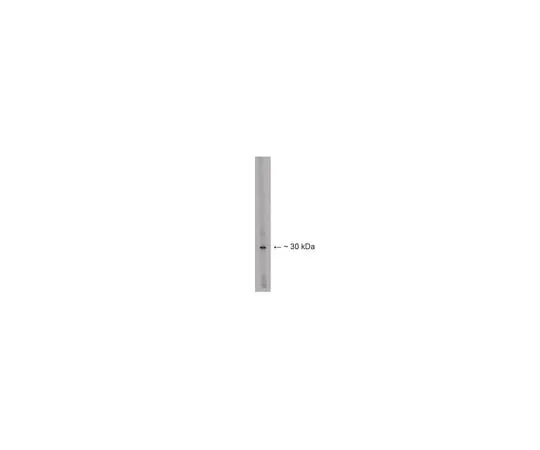 62-8455-02 Anti-Lbx1; 100 μg AB15292