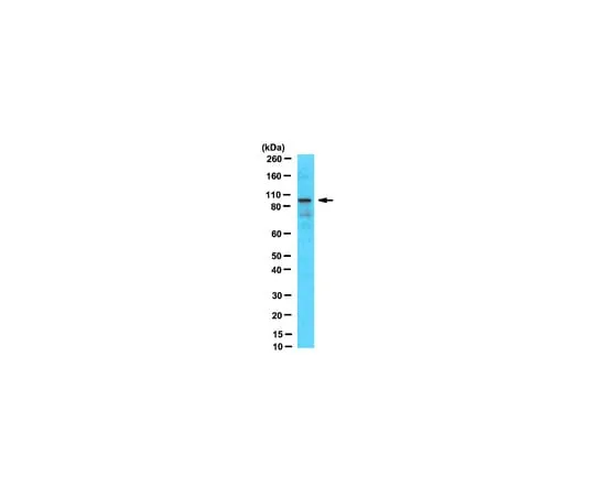 62-8369-52 Anti-Ataxin-7, clone 3SCA-1C1; 100 μL 04-1573