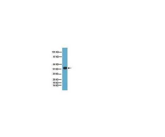 62-8445-18 Anti-Tryptophan Hydroxylase; 100 μL AB1541