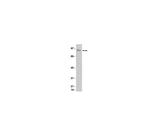 62-8385-96 Anti-ATRIP; 200 μL 07-625