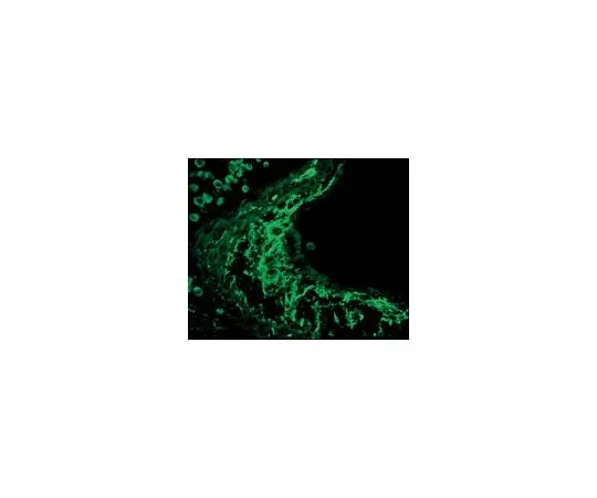 62-8456-19 Anti-Tenascin; 50 μg AB19013